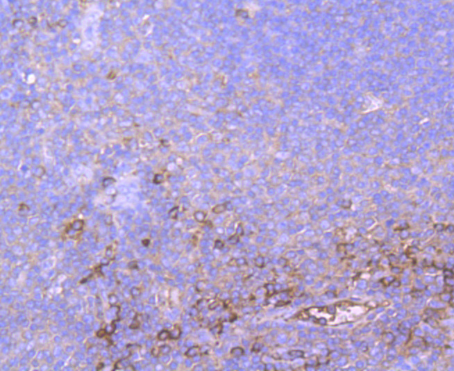 A2M Rabbit mAb