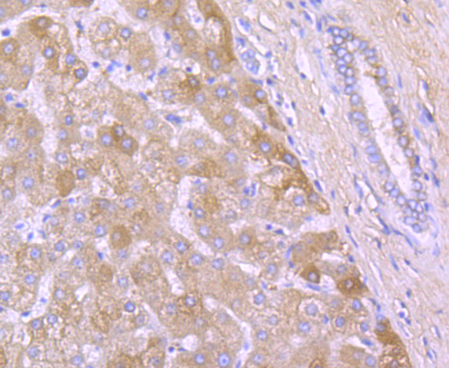 A2M Rabbit mAb