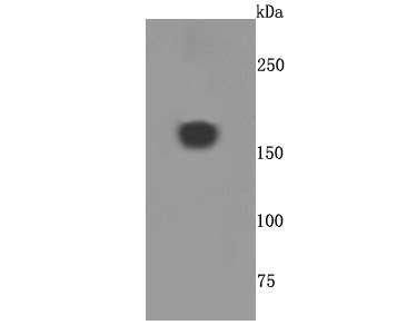 A2M Rabbit mAb