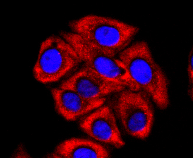 FMRP Rabbit mAb