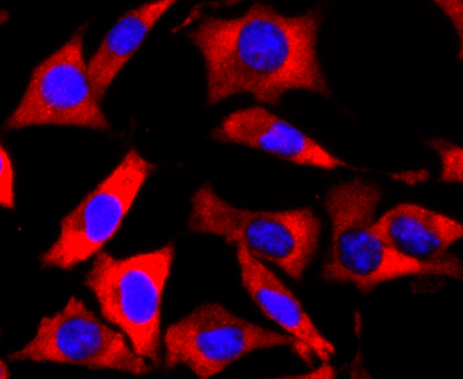 FMRP Rabbit mAb