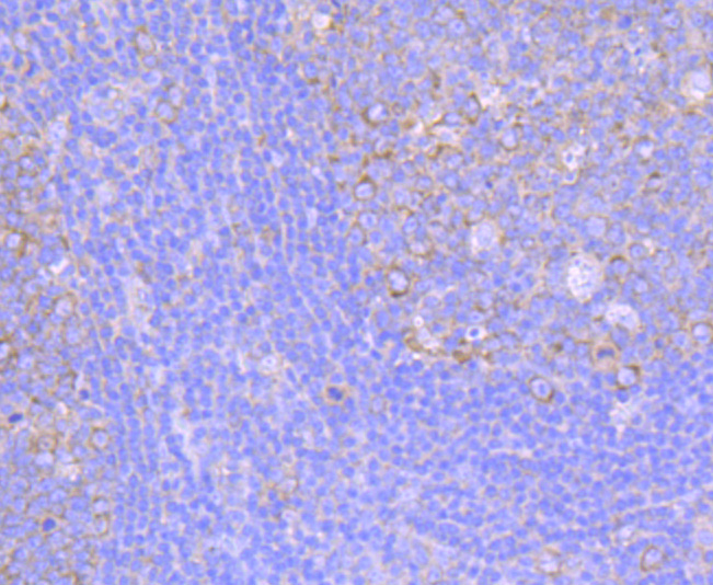 FMRP Rabbit mAb