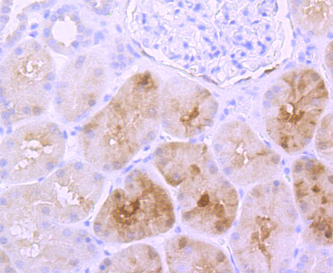 S100 Rabbit mAb