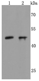 NeuroD1 Rabbit mAb