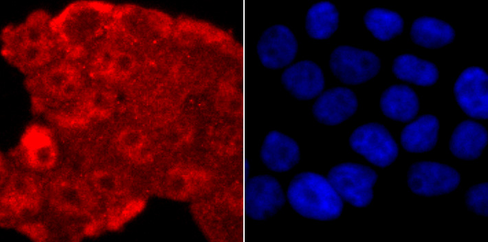 TDP43 Rabbit mAb