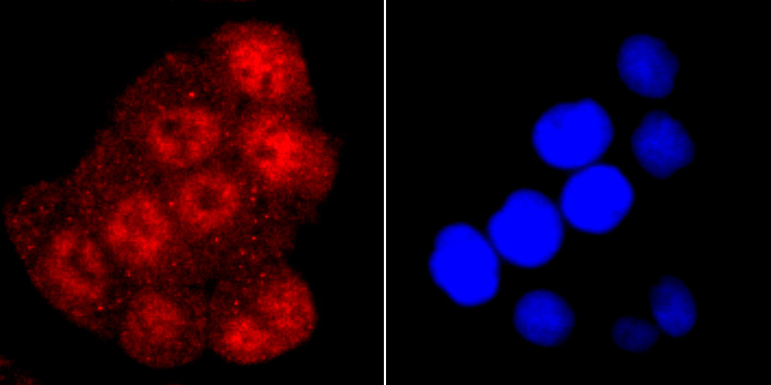 TDP43 Rabbit mAb