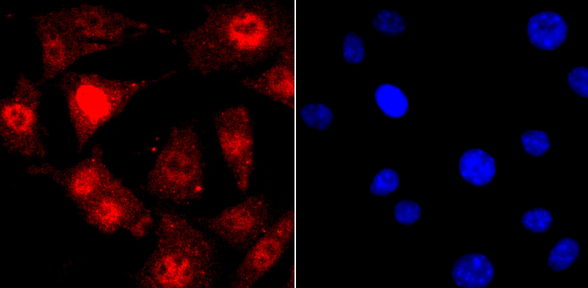 TDP43 Rabbit mAb