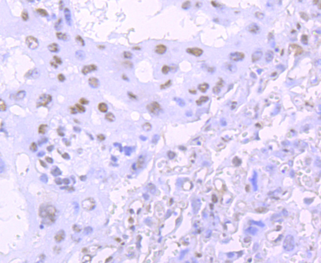 TDP43 Rabbit mAb