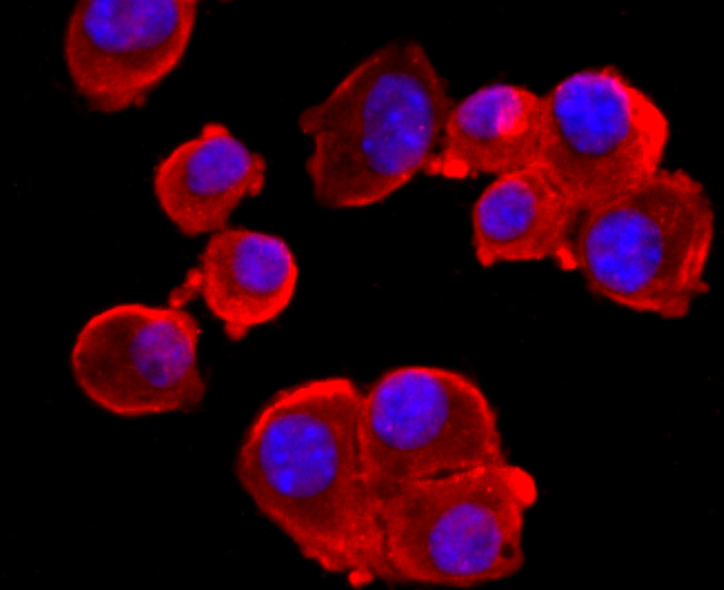 NMDAR1 Rabbit mAb