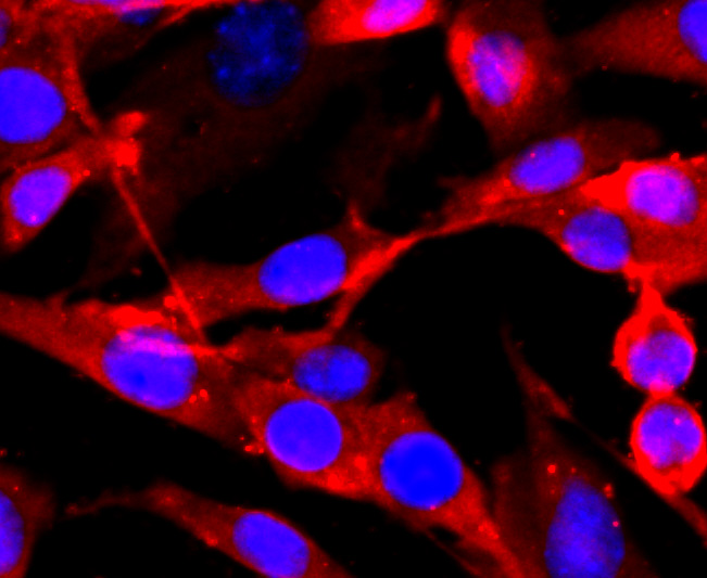 NMDAR1 Rabbit mAb