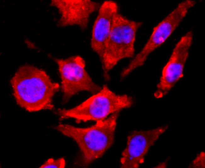 NMDAR1 Rabbit mAb