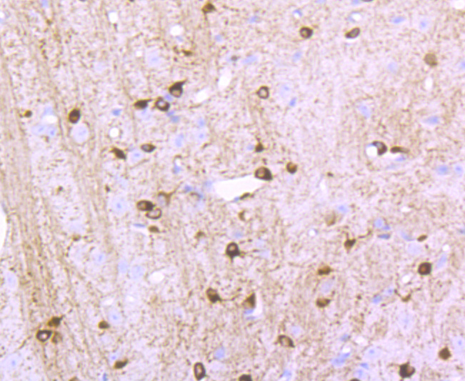 NMDAR1 Rabbit mAb