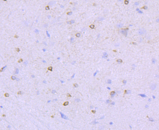 NMDAR1 Rabbit mAb