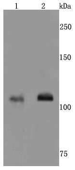 NMDAR1 Rabbit mAb