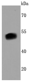 FOXA2 Rabbit mAb