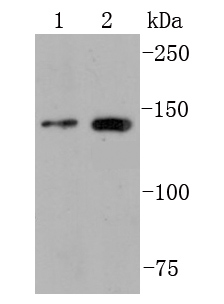 FGFR2 Rabbit mAb