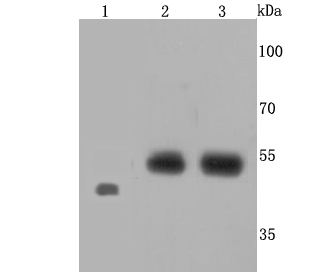 Endothelin B Receptor Rabbit mAb