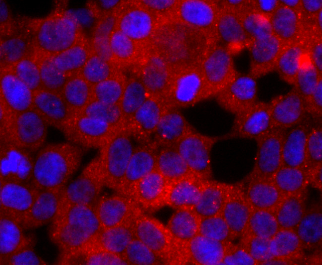 Rac1-2-3 Rabbit mAb