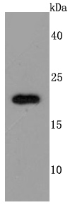 TIMP2 Rabbit mAb