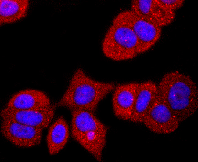 TTR Rabbit mAb