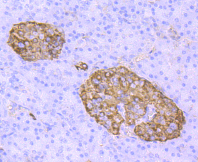 TTR Rabbit mAb