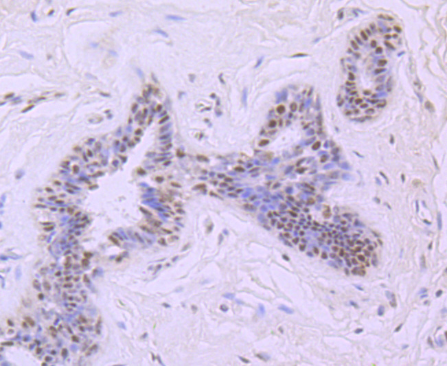 Mre11 Rabbit mAb