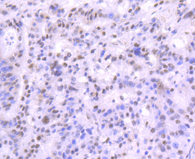 Mre11 Rabbit mAb