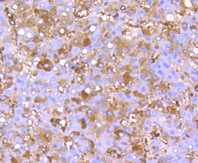 FGF21 Rabbit mAb