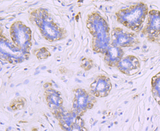 FGF21 Rabbit mAb