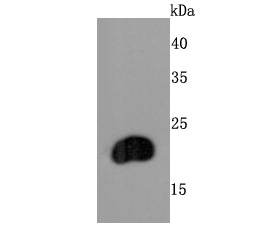 FGF21 Rabbit mAb