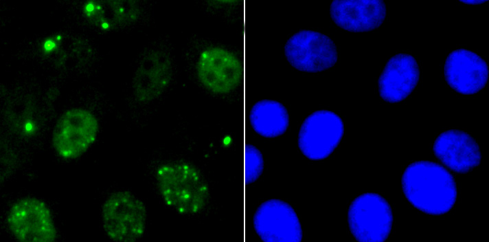 53BP1 Rabbit mAb