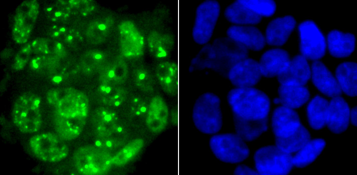 53BP1 Rabbit mAb