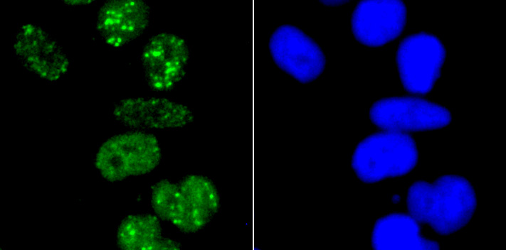 53BP1 Rabbit mAb