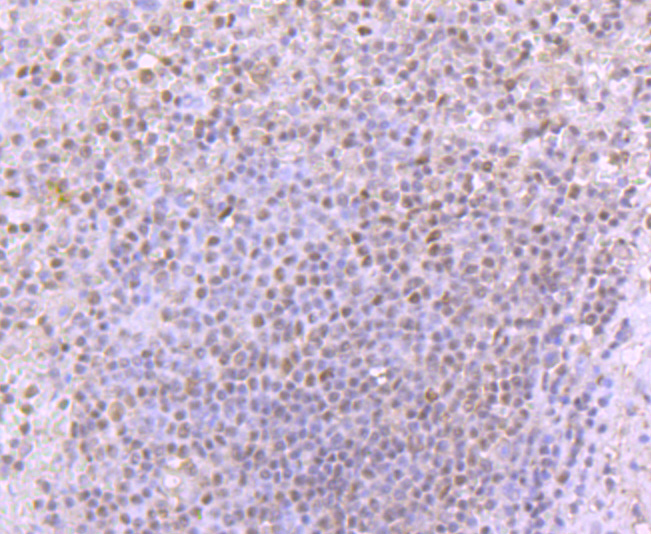 53BP1 Rabbit mAb