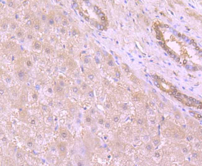 53BP1 Rabbit mAb