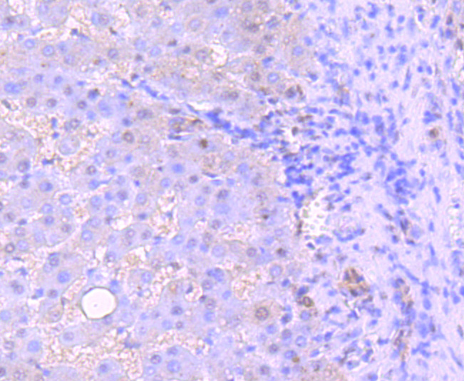 53BP1 Rabbit mAb