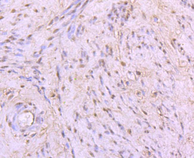 53BP1 Rabbit mAb