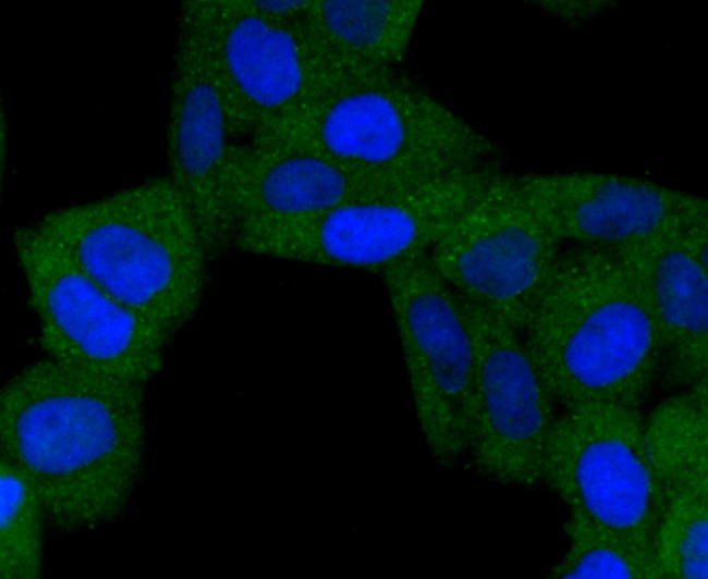 BNIP3 Rabbit mAb