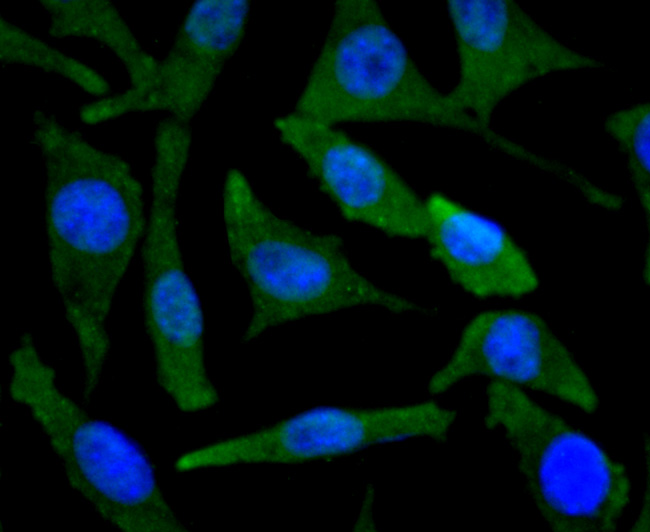 BNIP3 Rabbit mAb