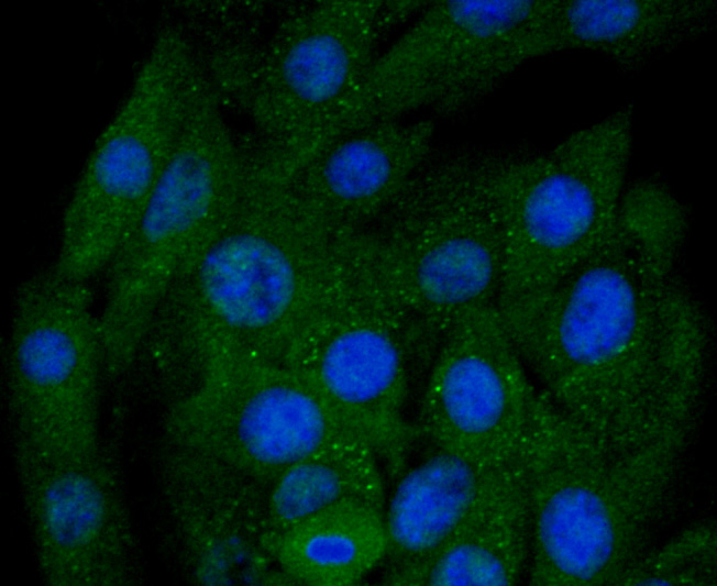 BNIP3 Rabbit mAb