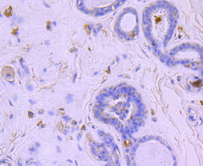 BNIP3 Rabbit mAb