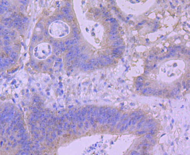 BNIP3 Rabbit mAb