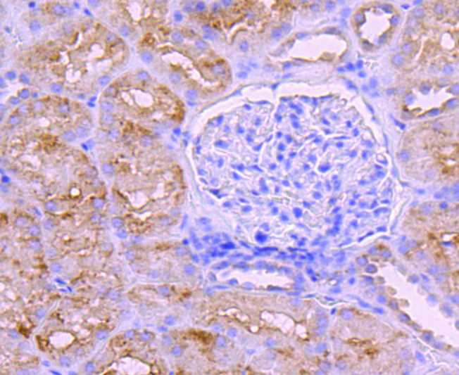 BNIP3 Rabbit mAb