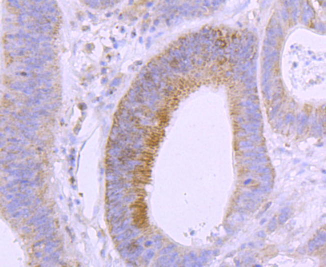 Vitamin D Receptor Rabbit mAb