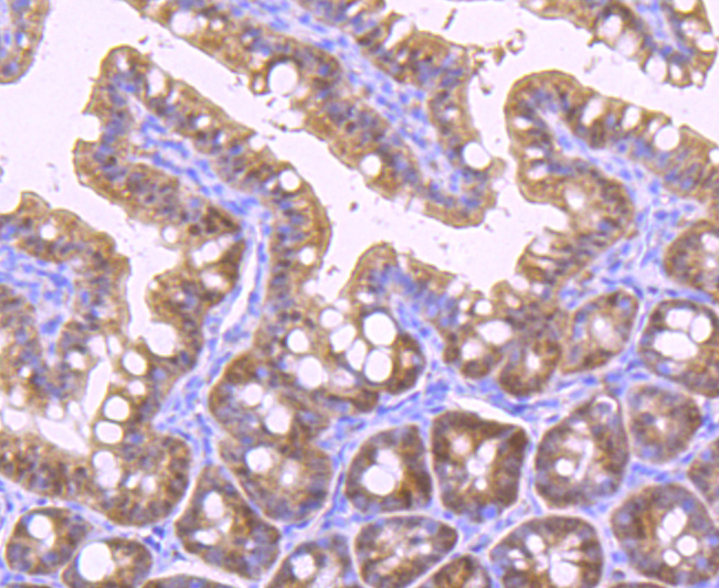 Vitamin D Receptor Rabbit mAb