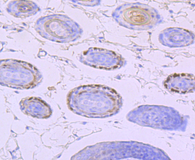 Vitamin D Receptor Rabbit mAb