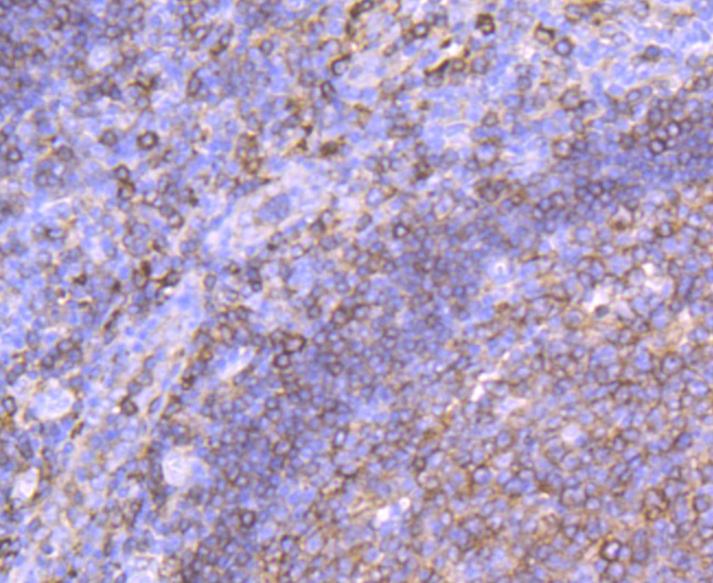 MHC Class II Rabbit mAb