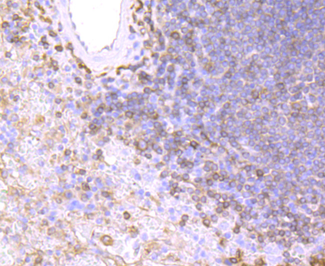 MHC Class II Rabbit mAb