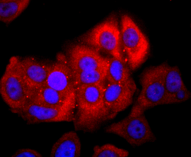 NFAT1 Rabbit mAb