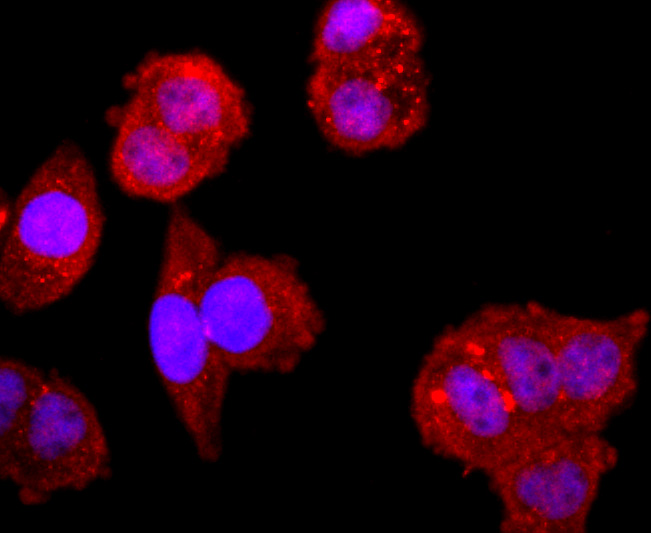 NFAT1 Rabbit mAb